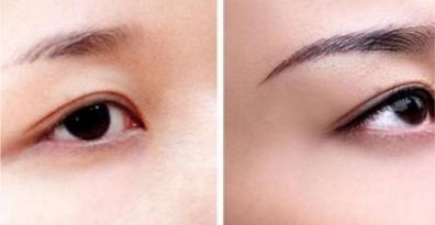 重慶頂尖眼部整形醫(yī)生、醫(yī)院排行榜一覽
