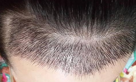 看看這八家贛州整形醫(yī)院有沒有靠譜的？你知道嗎？
