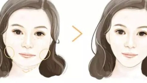濟(jì)南整形美容醫(yī)院哪家好？諾德、藝星、韓氏躋身手術(shù)排行榜