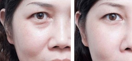 上海治療疤痕的醫(yī)院排名出爐！五家專業(yè)醫(yī)院實力震撼，趕快了解！
