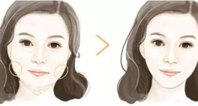 上海豐臀醫(yī)院排名推薦：性價比高的醫(yī)療機構默默無聞！