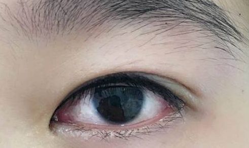 上海整形界最受歡迎的吸脂專家推薦，李耐國、曹衛(wèi)剛、李發(fā)成等醫(yī)生備受贊譽！附真實案例供參考