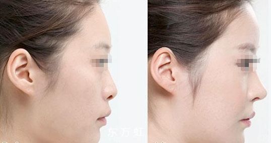 蘇州無線頻率融脂?？漆t(yī)生排名前十這幾位醫(yī)術(shù)聲譽(yù)超卓的醫(yī)生是您的不二之選