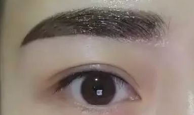 上海瑞格整形醫(yī)院領銜醫(yī)師羅瀾濤——重塑美麗眼睛的魔法使者，成功案例揭秘！