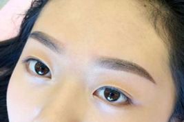 如何優(yōu)雅地?fù)碛须p眼皮？了解專家經(jīng)驗與最新案例！