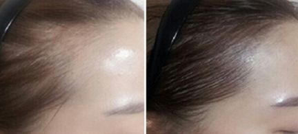 鄭州芳藝醫(yī)療整形醫(yī)院有沒有特色項目？如何一鍵獲取？