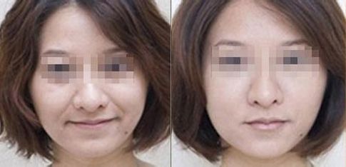 成都有哪些專業(yè)的雙眼皮整形醫(yī)生值得推薦？