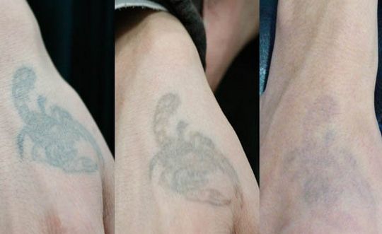 長沙哪家整形醫(yī)院技術(shù)靠譜？私立醫(yī)美還可信嗎？
