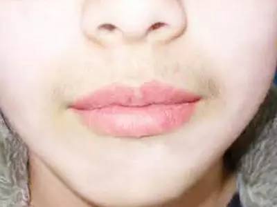 無錫三院整形科哪位醫(yī)生會更受關注？