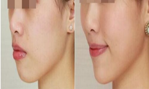 北京最強(qiáng)雙眼皮醫(yī)院推薦，安貞、美萊、八大處霸主爭鋒！