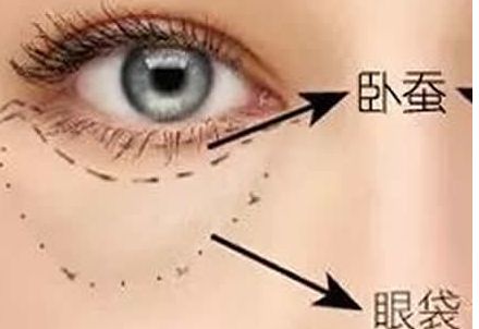 北京協(xié)和醫(yī)院隆胸案例與醫(yī)生簡(jiǎn)介含金量如何？收費(fèi)是否合理？
