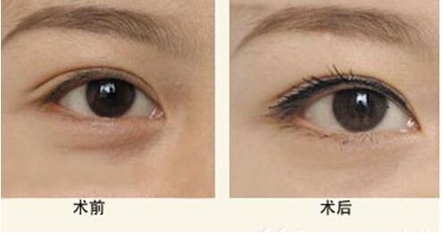 【獨(dú)家】上海九院整形科醫(yī)生王琛醫(yī)生的專長(zhǎng)與案例分享 【獨(dú)家】上海九院整形科醫(yī)生王琛醫(yī)生的專長(zhǎng)與案例分享