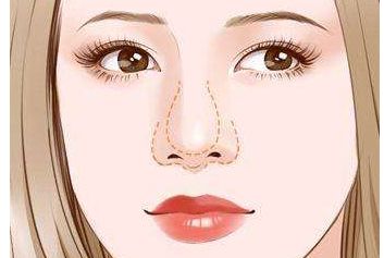 濟南哪家醫(yī)生做雙眼皮效果好？謝燕燕醫(yī)生實力及案例揭秘！