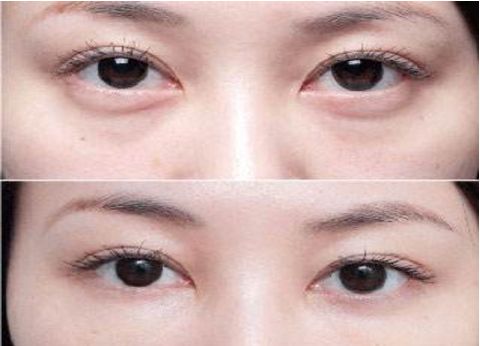 杭州專業(yè)整容醫(yī)療機構(gòu)排行榜大揭秘！藝術(shù)之星醫(yī)療集團對比時光整形大賽！真實原因還原無遺！