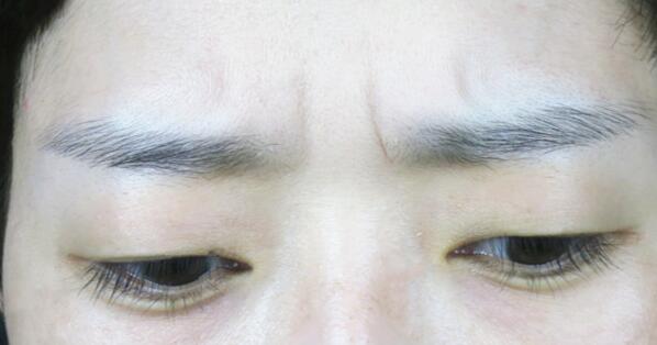 河北醫(yī)科大學(xué)第二醫(yī)院項(xiàng)目有哪些？醫(yī)生技術(shù)如何提供？