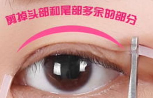 樂山市人民醫(yī)院眼袋手術口碑如何？醫(yī)生推薦+真實案例分析