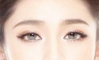 石家莊美聯(lián)臣雙眼皮整形靠譜嗎？有哪些優(yōu)秀醫(yī)生？有什么成功案例供參考？
