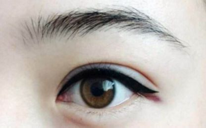 南寧醫(yī)科大雙眼皮整形費用及技術(shù)綜述！名單與收費指南分享