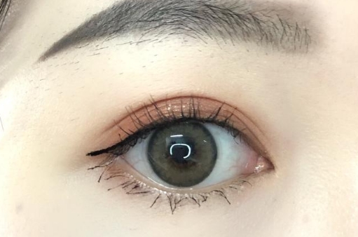 葉秀娣吸脂效果如何？值得一試嗎？