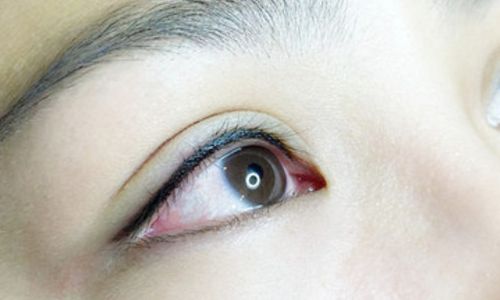 劉中國醫(yī)生成都潤美玉之光整形醫(yī)院的口碑是否好？大腿吸脂術(shù)效果如何呢？