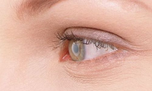 航空院眼袋手術(shù)效果如何？最新案例分享
