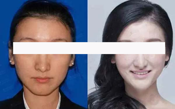 寧波藝星整形和珈禾整形，哪家更具實(shí)力？醫(yī)生口碑、項(xiàng)目擅長(zhǎng)和地址公布等方面的對(duì)比如何？