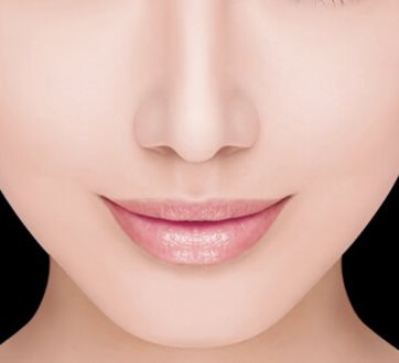 哈醫(yī)大四院李巍主治醫(yī)生鼻整形手術(shù)！80天重塑完美鼻型全記錄！