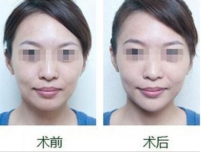 沈陽市的專業(yè)雙眼皮整形醫(yī)院哪家好，排名前三值得信賴