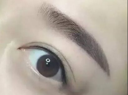 護眼實踐：林琦東如何改善視力？真實案例揭示眼部整形費用