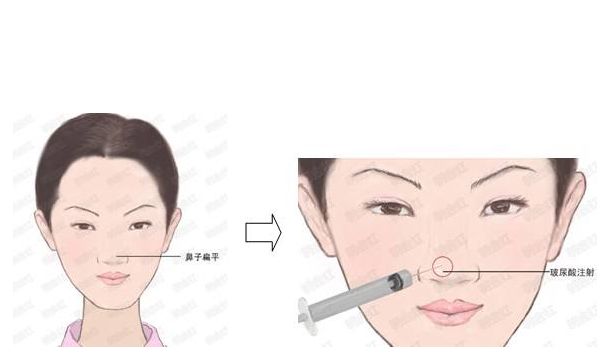 河南省整形醫(yī)院推薦：華領、維多利亞與締萊美大放異彩！