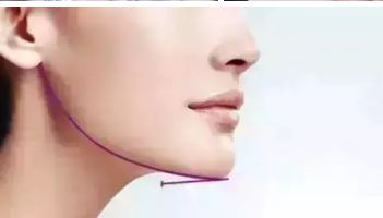 長(zhǎng)沙愛思特整形醫(yī)院：正規(guī)可信賴，服務(wù)周到！