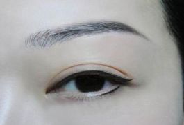深圳著名眼袋整形專家?guī)湍獯?，鵬程醫(yī)院是否值得選擇？