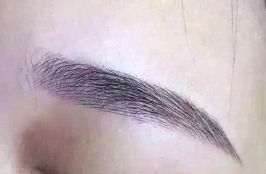 長沙脂肪吸取專家揭秘：技術(shù)卓越，無數(shù)口碑背后的醫(yī)美奇跡！