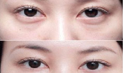 成都眼部整形醫(yī)生高分榜單發(fā)布！這些醫(yī)生哪家強？附詳細醫(yī)生信息