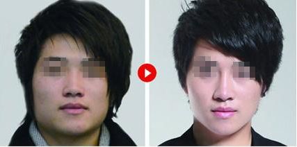 廣州美萊田躍平醫(yī)生為您帶來的鼻部整形體驗(yàn)案例曝光 廣州美萊田躍平醫(yī)生為您帶來的鼻部整形體驗(yàn)案例曝光