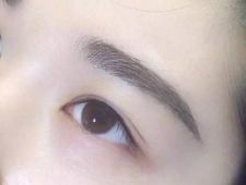 李炳澮醫(yī)生獨(dú)特的技術(shù) 手術(shù)風(fēng)格有何特點(diǎn)？并附帶隆鼻案例分析
