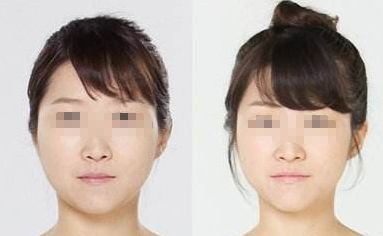 廣州哪家醫(yī)院能夠有效除皺？詳細介紹醫(yī)院基本情況分享