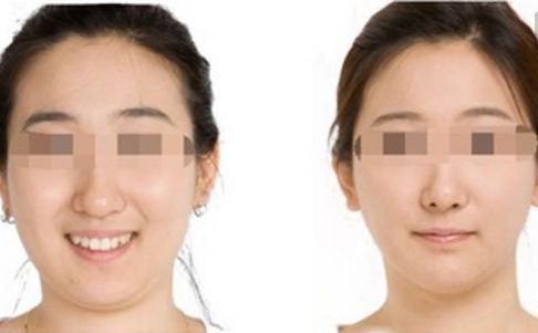 鄭州哪位醫(yī)生在鼻整形領域赫赫有名？口碑出類拔萃的五位專家揭曉！