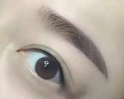 廈門哪家整形醫(yī)院口碑好？專家推薦薇格、中山前三！