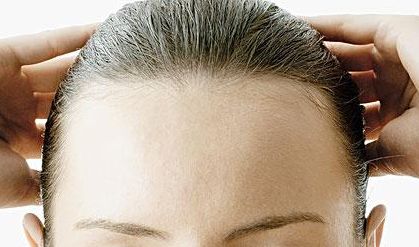 郭建玲雙眼皮修復(fù)費(fèi)用揭秘！看真實(shí)案例圖分享，了解其技術(shù)效果！