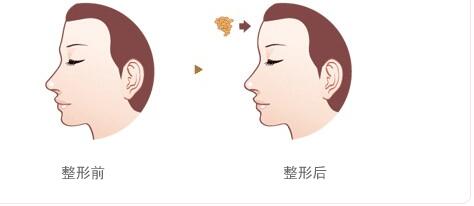 綿陽碧蓮盛植發(fā)醫(yī)院的效果如何？如何查詢地址及醫(yī)生信息？