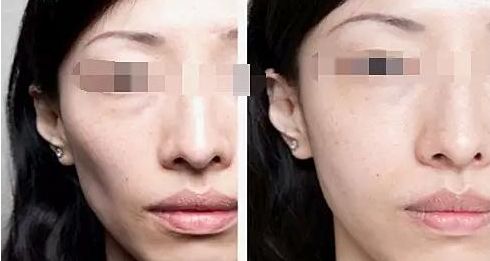 廈門(mén)整容醫(yī)院實(shí)力排名揭曉，輕松擁有美麗容顏！
