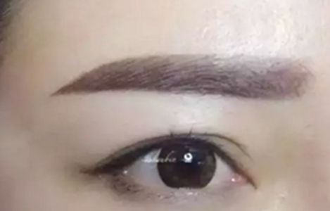 南昌美伊爾醫(yī)院的劉立軍醫(yī)生手術(shù)實(shí)力如何？擅長哪些手術(shù)？附真實(shí)案例為參考