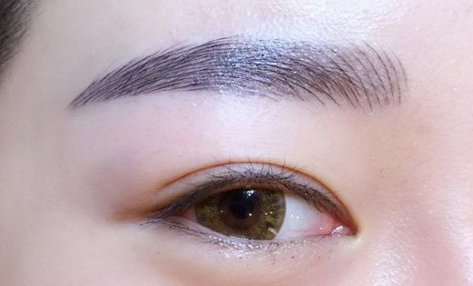 徐利剛：杭州藝星整形臨床實力派！鼻子整形解析，案例詳解！