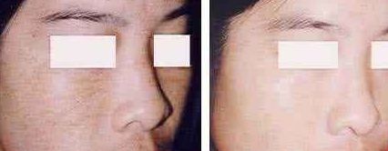 福州美貝爾醫(yī)療美容門診部：薛欣醫(yī)生用戶評價高？真實案例分享！