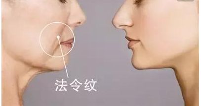 韋元強(qiáng)swan吸脂修復(fù)方法介紹，相關(guān)醫(yī)院推薦