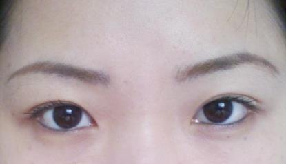 北京明會紅醫(yī)療美容診所價格表真實嗎？你會不會覺得有點匪夷所思？