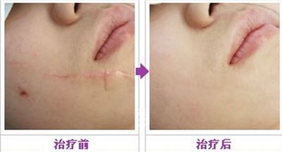 重慶神奇醫(yī)療機構(gòu)，致力于脂肪填充醫(yī)療服務(wù)的機構(gòu)盤點