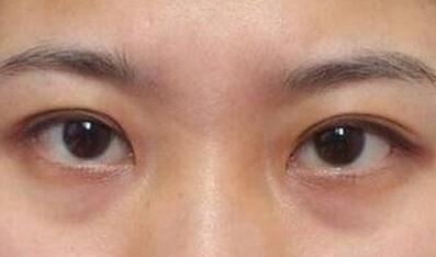 杭州東方整形吸脂到底值不值得嘗試？