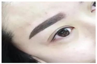 無(wú)錫伊爾美整形醫(yī)院丨2023最火隆胸案例分享 無(wú)錫伊爾美整形醫(yī)院丨2023最火隆胸案例分享